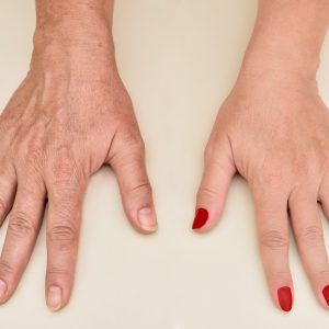 Before-and-after-hands
